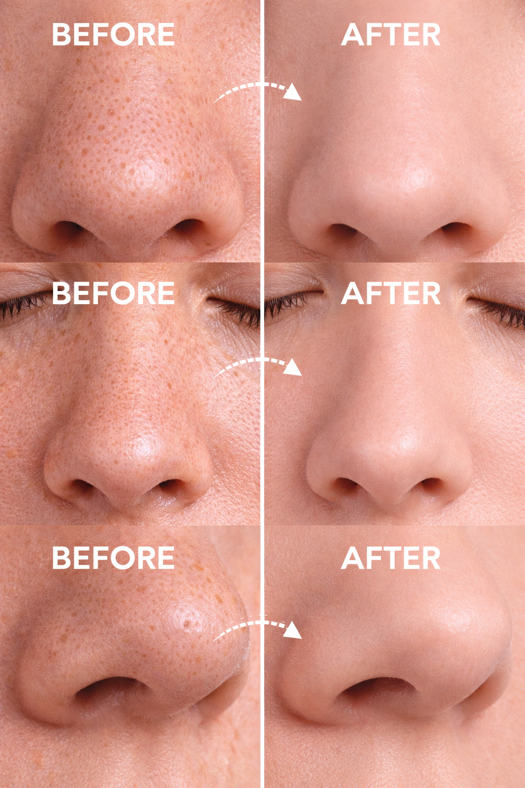 PoreClean Pro™ — Instantly Remove Blackheads & Deep Clean Pores