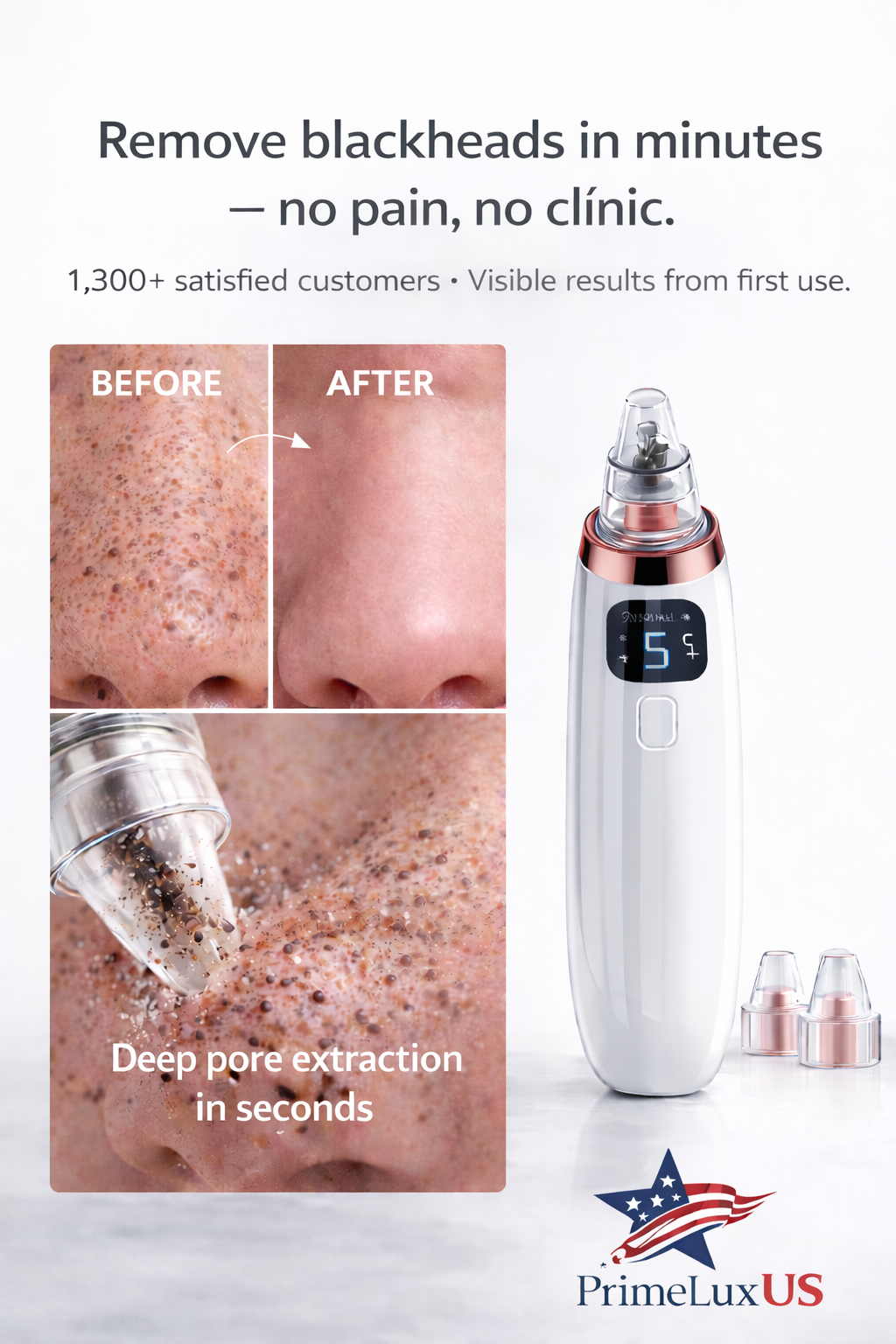 PoreClean Pro™ — Instantly Remove Blackheads & Deep Clean Pores