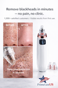 PoreClean Pro™ — Instantly Remove Blackheads & Deep Clean Pores